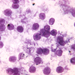 pneumocystis carinii (toluidinkék)